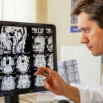 A doctor looks at scans of a brain on a computer