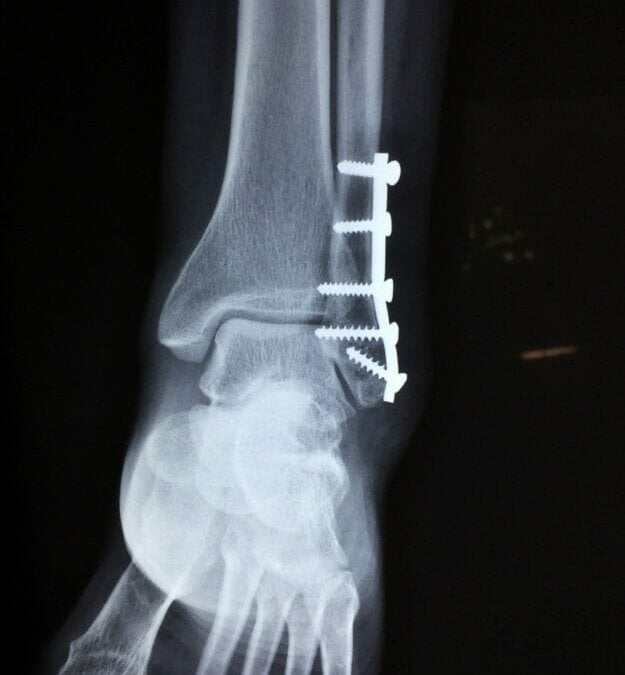 x-ray Pain and Suffering