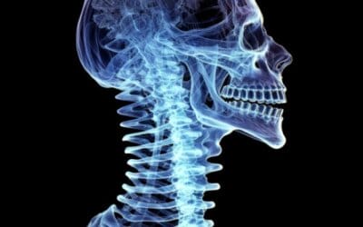 Dealing With Whiplash After a Car Accident
